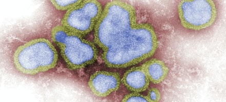 Virusverwijdering en opschoning