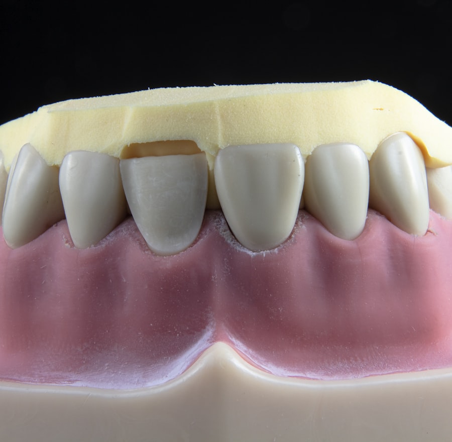 Resin dental model